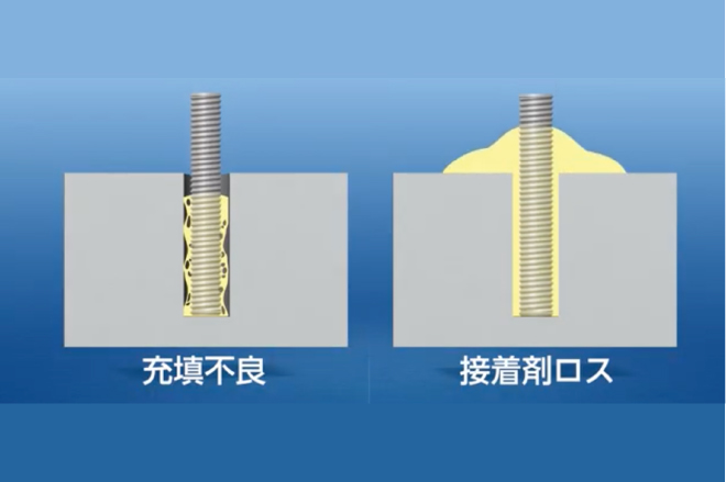 あと施工アンカー注入方式の課題